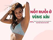 Nốt ruồi ở vùng kín nam và nữ tốt hay xấu? Có nên tẩy không?