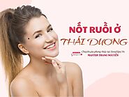 Nốt ruồi nằm ở thái dương mang ý nghĩa tướng số tốt hay xấu?