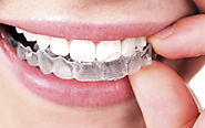 Everything You Need to Know About Braces