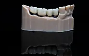 Reliable Dental Bridges in Markham for a Complete, Natural Smile