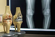 How Humidity Affects Joints – Joint Replacement Surgery in Delhi – @joint-replacement-surgery on Tumblr