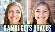 Kamri Gets Braces! | Behind the Braids Ep.4