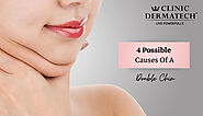 4 Possible Causes Of A Double Chin At Clinic Dermatech
