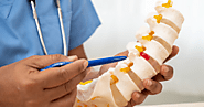 Importance of Physiotherapy for Ankylosing Spondylitis