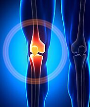 Physiotherapy After Knee Replacement Surgery