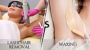 Laser Hair Removal vs. Waxing: Which Is Better for You?