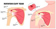 When Should You Not Ignore Shoulder Pain? Causes, Symptoms, and Effective Osteo Treatments for a Sore Shoulder