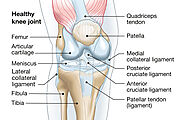 Knee Pain: Symptoms, Causes & Evidence-Based Osteo Health Treatments