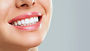How Teeth Whitening Boosts Your Smile's Aesthetic Appeal  