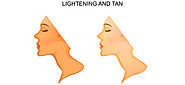 20 Ways to Lighten Skin Tone | Skincare Tips by MedLinks