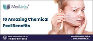10 Amazing Chemical Peel Benefits - Medlinks Look Good