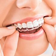 Get the Best Invisalign in Mumbai for a Perfect Smile Transformation