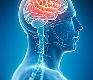 Best Neurologist Hospital in Bhopal | Specialized Neurology Care at Shree Hospital