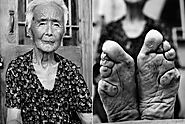 Why Footbinding Persisted in China for a Millennium