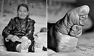 Unbound: China's last 'lotus feet' – in pictures