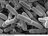 An introduction to B.thuringiensis: Take a look at this brilliant image of this prokaryote under a microscope, using ...