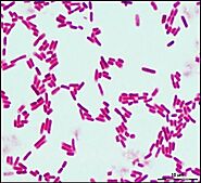 Gram-negative, rod shaped Nitrosomonas europaea