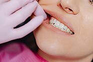 Exploring the Link Between HPV and Oral Health