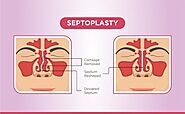 Effective ENT Solutions for Congestion & Snoring in Vasant Kunj