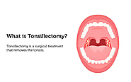 Veekay Clinic: The Most Trusted ENT Clinic for Throat Issues