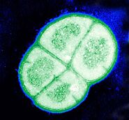 Radio fluorescence imaging of Deinoccocus Radiodurans