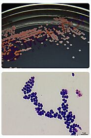 Deinococcus radiodurans grown on trypticase soy agar and it's Gram-positive stain reaction