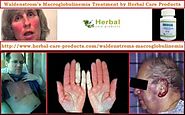 Natural Herbal Treatment for Waldenstrom’s Macroglobulinemia and Symptoms, Causes - Herbal Care Products Blog