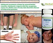 Natural Herbal Treatment for Ichthyosis and Symptoms, Causes - Herbal Care Products Blog