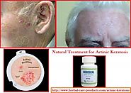 Natural Herbal Treatment for Actinic Keratosis and Symptoms, Causes - Herbal Care Products Blog