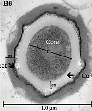 Importance of bacterium