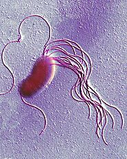 Medical significance of Pseudomonas fluorescens