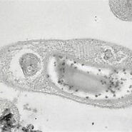 Here is an image of Candidatus Desulforudis audaxviator, the remarkable bacterium discovered deep within the Earth's ...
