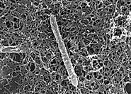 Electron Micrograph of Candidatus Desulforudis audaxviator.