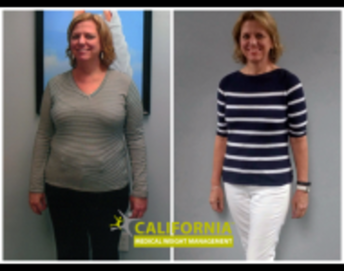 Weight Loss Doctors In California A Listly List