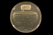 Rhizobium - Wikipedia