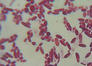 Meet Pseudomonas stutzeri – The Eco-Friendly Bacterium 🦠