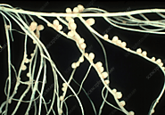 Pink nodules of Rhizobium leguminosarum