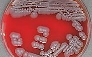 Colony characteristics... i.e. Pigmentation, Morphology