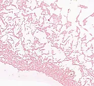 METABOLISM and ENVIRONMENTAL SIGNIFICANCE