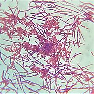 Bacterial Gram stain of P. fluorescens