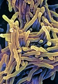 Mycobacterium tuberculosis under the microscope