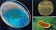 colonies of Pseudomonas fluoroscens