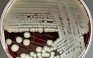 Pure Culture of Bacillus thuringiensis (Bt)
