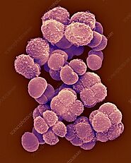 Gram staining reaction