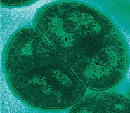 Deinococcus radiodurans bacterium