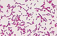 Pseudomonas putida characteristics
