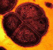 Deinococcus radiodurans