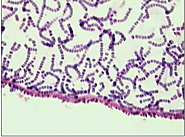 Figure 2: micrograph showing Gram reaction of Nostoc sphaeriodes