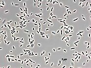 General characteristics of Pseudomonas putida