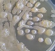 Trichococcus flocculiformis in an agar plate